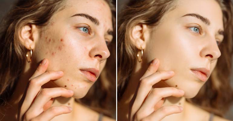 Portrait Retouching